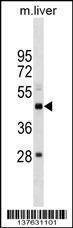 Anti-SETD4 (N-term) Antibody