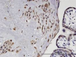 Anti-EDG3 Antibody