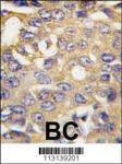 Anti-AMBRA1 (N-term) Antibody