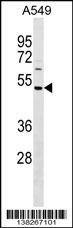 Anti-HAUS8 (N-term) Antibody