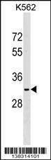 Anti-NKX6-2 (N-term) Antibody