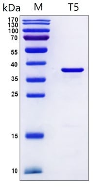 Figure 1. SDS-PAGE analysis of purified T5 product. M, protein ladder (kDa).