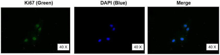 Anti-Ki-67 (3155-3178aa) Antibody