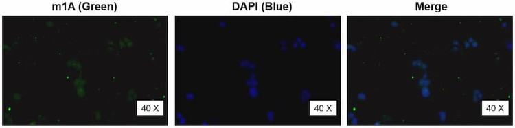 Anti-m1A Antibody