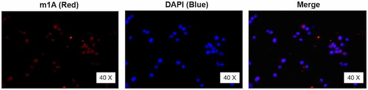 Anti-m1A Antibody