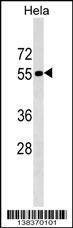 Anti-TIGD1 (N-term) Antibody