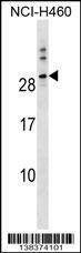Anti-TTYH1 (N-term) Antibody