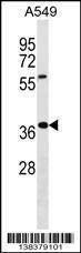 Anti-WDR61 (Center) Antibody