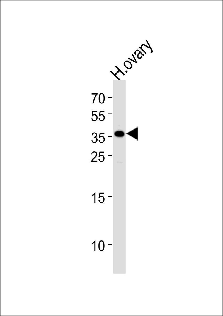 Anti-GNRHR (N-term) Antibody