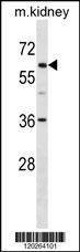 Anti-TFE3 (C-term) Antibody