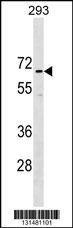 Anti-CCDC151 (N-term) Antibody