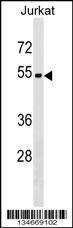 Anti-ZNF703 (Center) Antibody