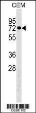 Anti-KLHL28 (C-term) Antibody