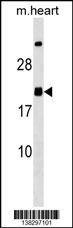 Anti-MED9 (C-term) Antibody