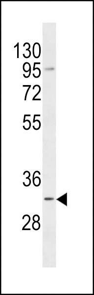 Anti-TACO1 (N-term) Antibody