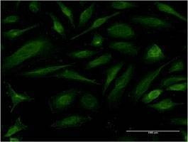 Anti-EIF1AY Antibody