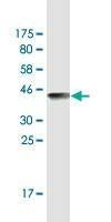 Anti-EIF2AK2 Antibody