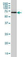 Anti-EIF2AK2 Antibody