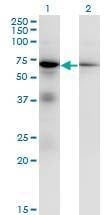 Anti-EIF2AK2 Antibody