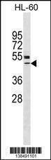 Anti-VDR Antibody