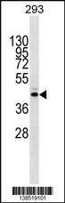 Anti-METTL2B (N-term) Antibody