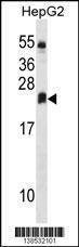 Anti-DHRS4L2 (Center) Antibody