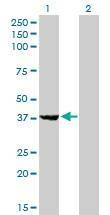 Anti-EIF2B2 Antibody