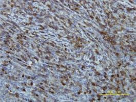Anti-EIF2B2 Antibody