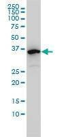 Anti-EIF2B2 Antibody