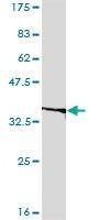 Anti-EIF2B2 Antibody