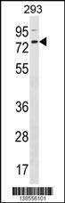 Anti-ZNF416 (C-term) Antibody