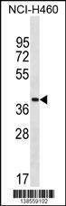 Anti-ZNF488 (Center) Antibody