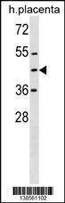 Anti-ZNF558 (Center) Antibody