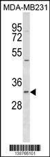 Anti-FAHD2B (C-term) Antibody