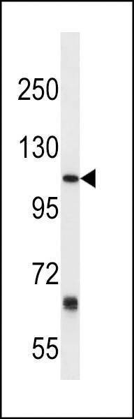 Anti-PTGFRN (Center) Antibody