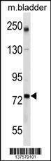 Anti-GCLC (Center) Antibody