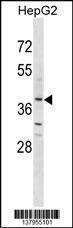 Anti-OR2K2 (N-term) Antibody