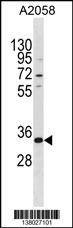 Anti-TGIF2LX (Center) Antibody
