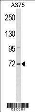 Anti-ZSWIM2 (C-term) Antibody