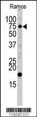 Anti-UVRAG (C-term L555) Antibody