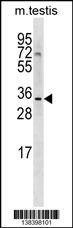 Anti-SHARPIN (Center) Antibody