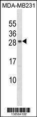 Anti-CHMP5 (C-term) Antibody