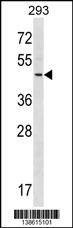Anti-RNF41 (C-term) Antibody