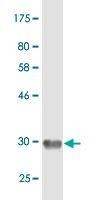 Anti-EMR4P Antibody
