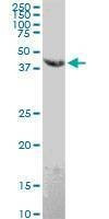 Anti-EMR4P Antibody