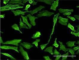 Anti-EMR4P Antibody