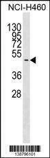Anti-GNAS (C-term) Antibody