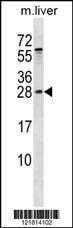 Anti-RAB5B (Center) Antibody