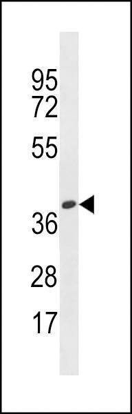 Anti-OR4X1 (N-term) Antibody