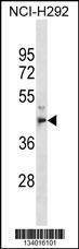 Anti-MPPE1 (C-term) Antibody